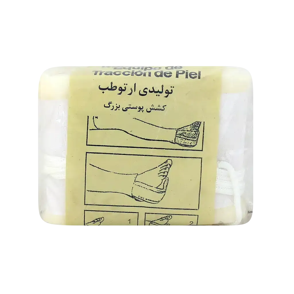 کشش پوستی بزرگ ارتوطب برای درمان شکستگی ها